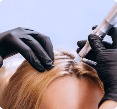 PRP Treatment For Hair Loss: Does it Work?