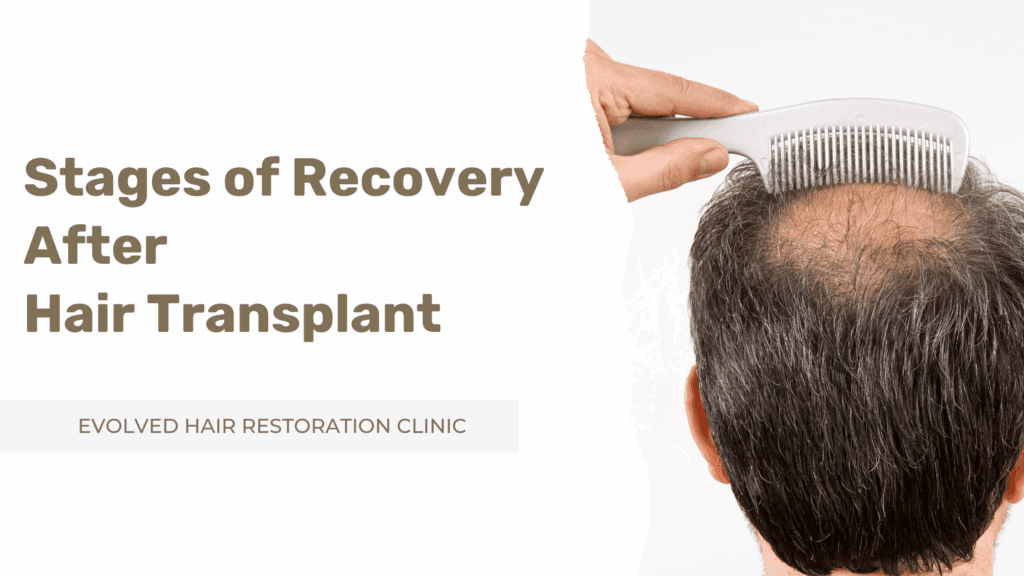 Hair Transplant and Mental Health