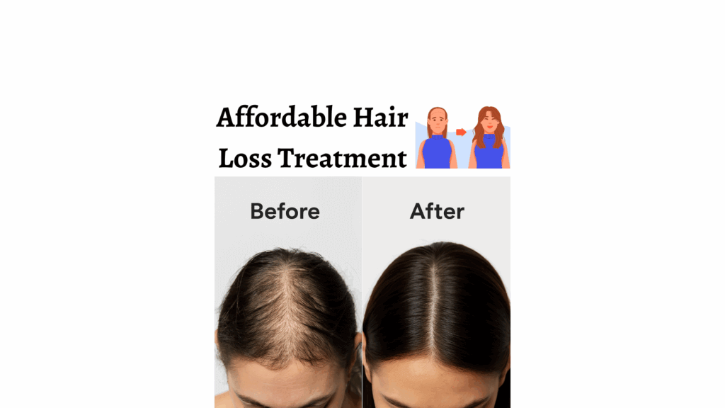 Hair Loss Treatments in Gurgaon