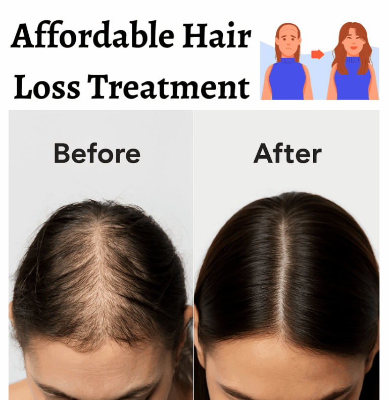 Hair Loss Treatments in Gurgaon
