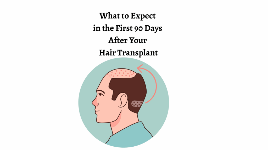 hair transplant